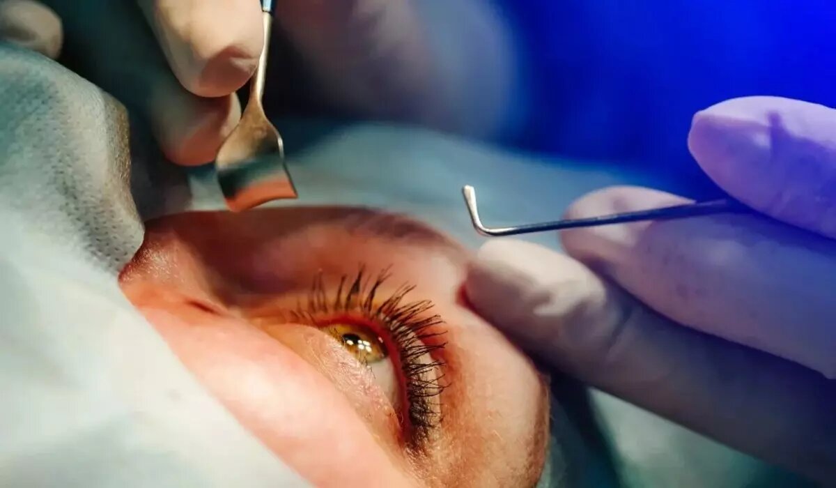 جراحی چشم - چشم پزشکی