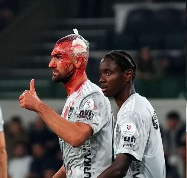 عکس| تصویر ترسناک از سردار دوسون!/ این هالووین نیست، خون واقعیه!