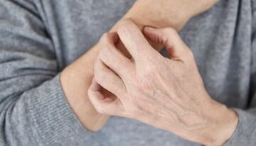 این نشانه‌ها یعنی بیماری پوستی